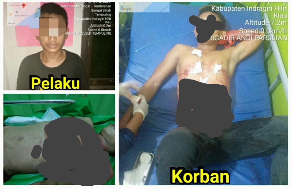 Remaja Ini Tusuk Korbannya Berulang-ulang