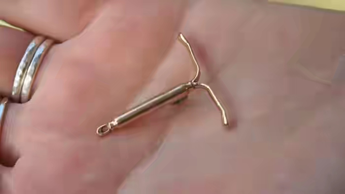 Terungkap! Inilah 5 Efek Samping KB Spiral yang Jarang Diketahui Para Wanita