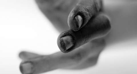 Tanda-tanda Penderita Kanker Semakin Dekat dengan Waktu Kematiannya