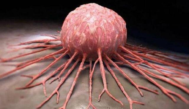 Konsumsi Lima Makanan Ini, Kanker Tumbuh di Tubuh Anda