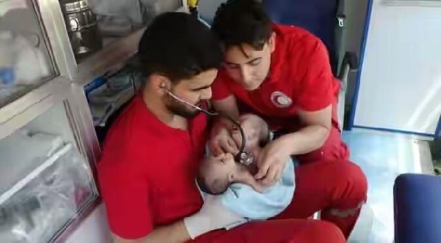Bayi Berkepala Dua Lahir di Zona Perang Suriah