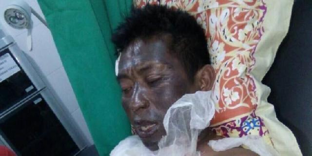 Periksa Gardu Listrik, Seorang Pegawai PLN Tersetrum hingga Wajahnya Gosong