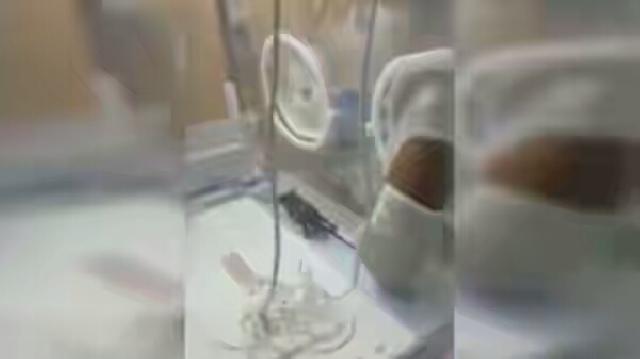 Bayi Prematur di dalam Inkubator Ini Dimakan Tikus
