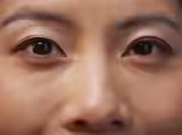 4 Penyebab Kedutan Tak Biasa: Cacing Parasit Hingga Overdosis Kafein