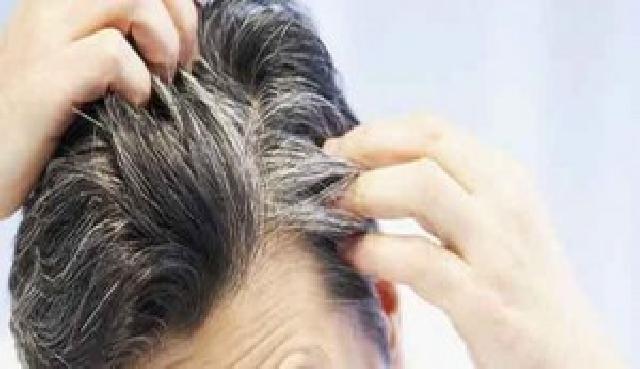 Faktor Penyebab Rambut Beruban