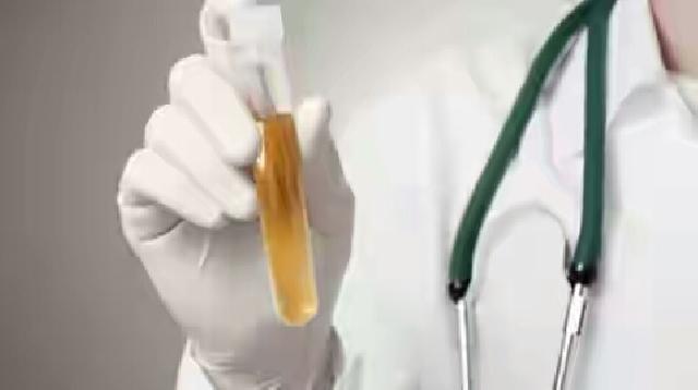 Jika Bau Urin Tidak Sedap Artinya Organ Tubuh Kamu Ini Sedang Rusak, Hati Hati Jangan Dibiarkan Baha