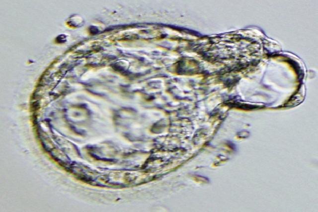 Dokter Kanada Diam-diam Hamili Pasien dengan Spermanya