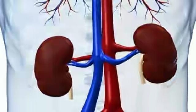 Ini Minuman Favorit Yang Bisa Bikin Gagal Ginjal