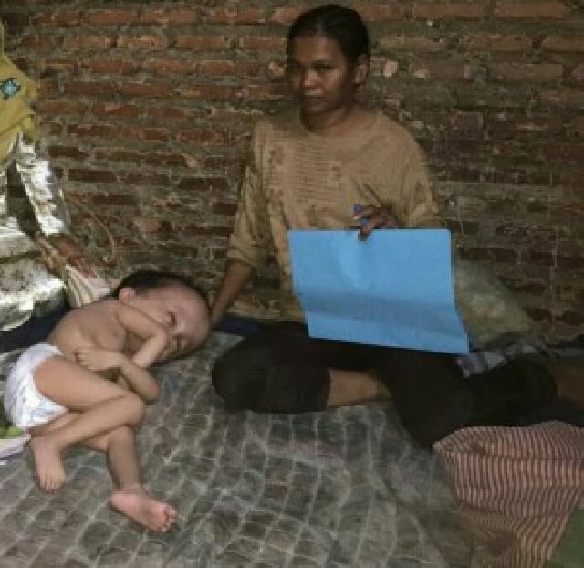 Dokter: Bayi Zakaria Harus Dipindai CT-Scan