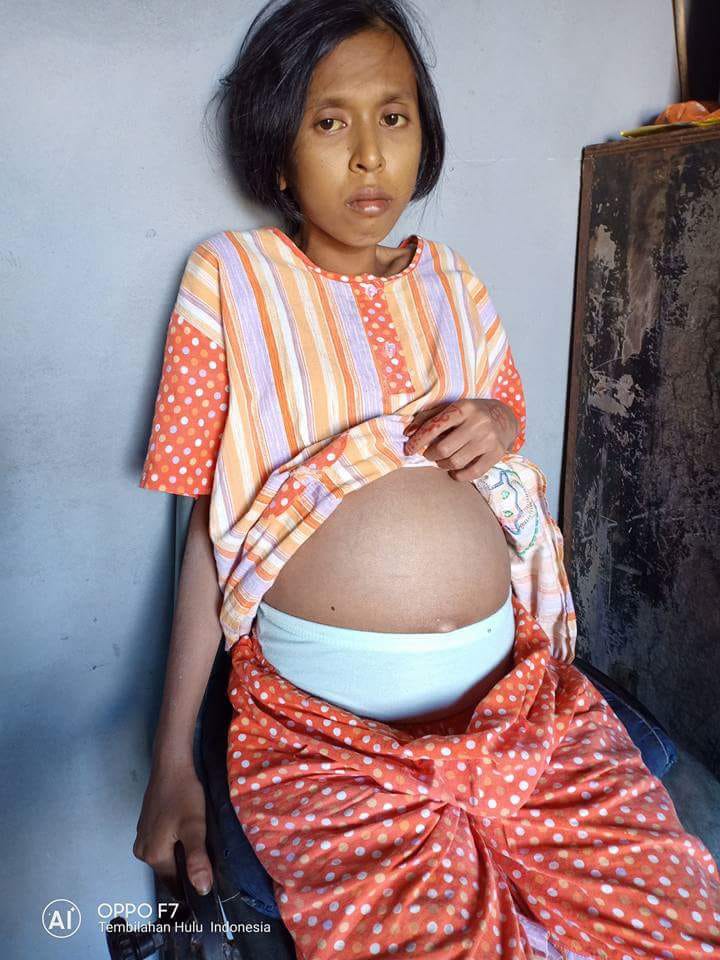 Mari Bersedekah Untuk Remaja 16 Tahun Di Inhil Ini