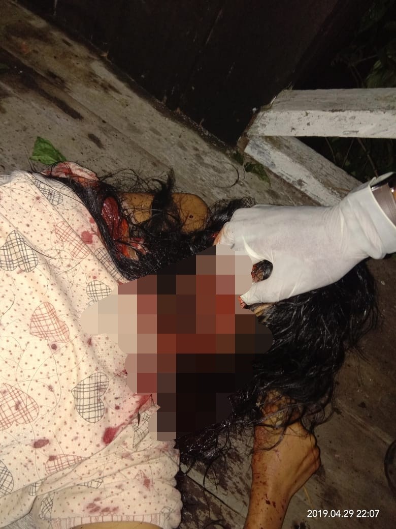 Pria Di Indragiri Hilir Ini Bacok Leher Istrinya