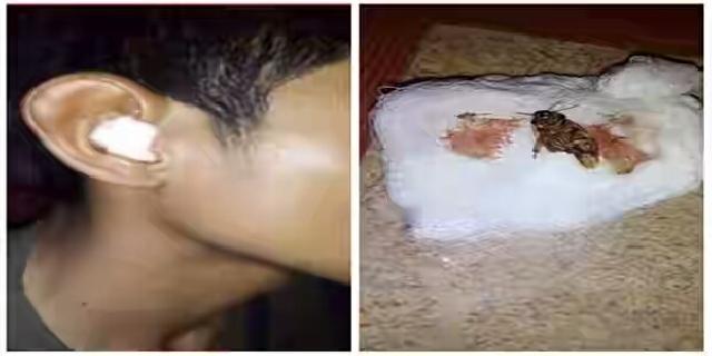 Pria Ini Guling Guling Kesakitan Gara Gara Kecoak Masuk ke Telinganya,