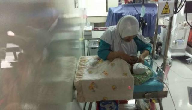 Bayi Kembar Siam di Ciamis, Gina 1 Meninggal Dunia