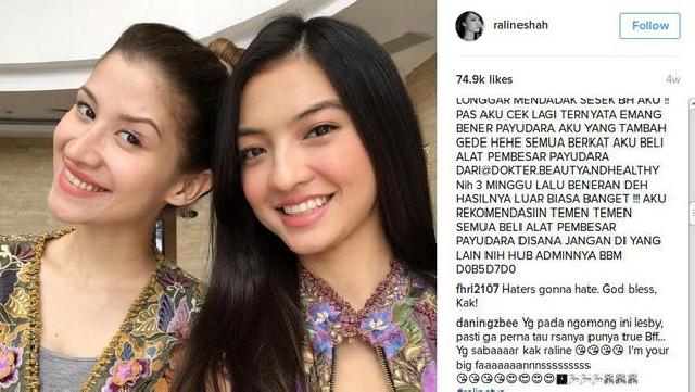 Dituding Penyuka Sesama Jenis, Millane Fernandez Bingung