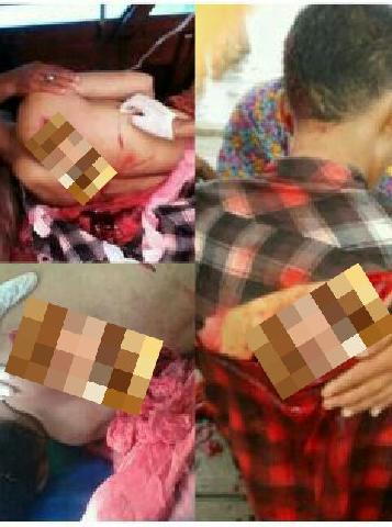 Korban Pembacokan di Mandah Akan Dirujuk ke Pekanbaru