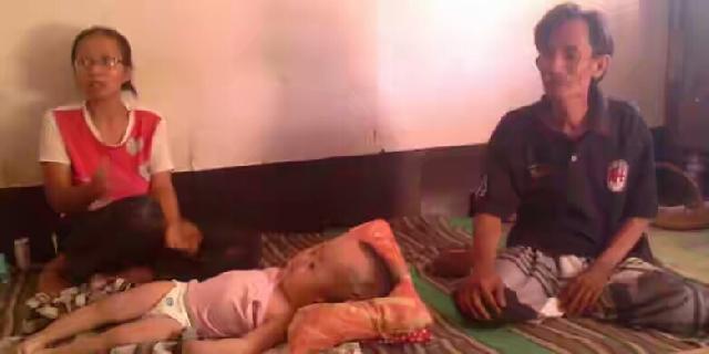 Bantuan Pemerintah Rp 500.000, Khusaeri Gadaikan Gubuk demi Obati Anak Balita Hidrosefalus