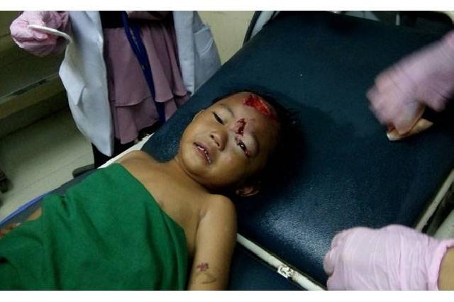 Bocah Empat Tahun Kritis Diterkam Anjing Liar