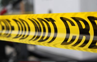 Telusuri Identitas Pemilik Potongan Kaki di Japos, Polisi Cari RS yang Lakukan Amputasi