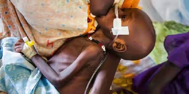Akibat Kelaparan Hebat, Ibu-ibu Sudan Selatan Tak Bisa Lagi Menyusui Anaknya