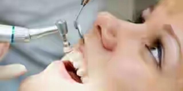 Jangan Lakukan 5 Hal Ini Setelah Anda Cabut Gigi