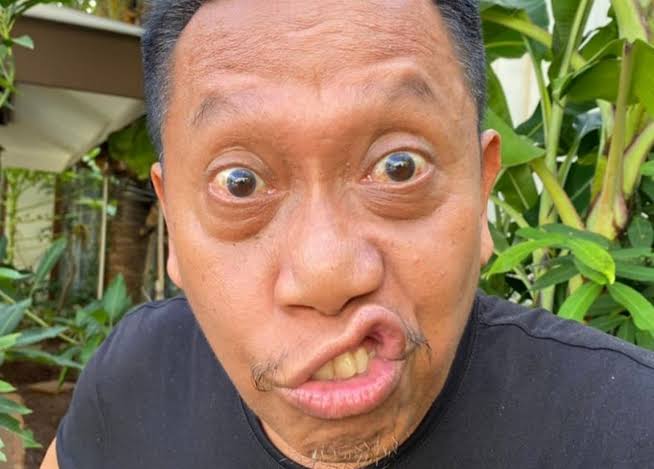 Tukul Arwana Alami Pembengkakan di Kepala, Ini Pengakuan Sang Anak