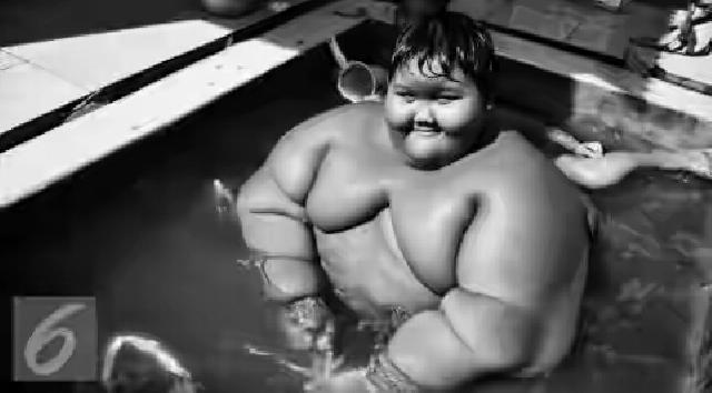 Bobot Bocah Obesitas Karawang Terus Turun, Semangat Arya