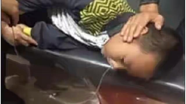 Dibully Kakak Kelasnya Memakan Batang Pensil. Bocah 10 Tahun Ini Jadi Seperti Ini