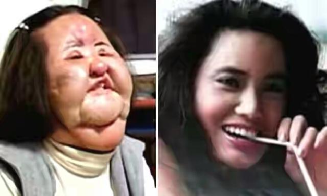 5 Orang Ini Ingin Jadi Cantik dengan Operasi Plastik Tapi Malah Berubah Jadi Seperti Monster
