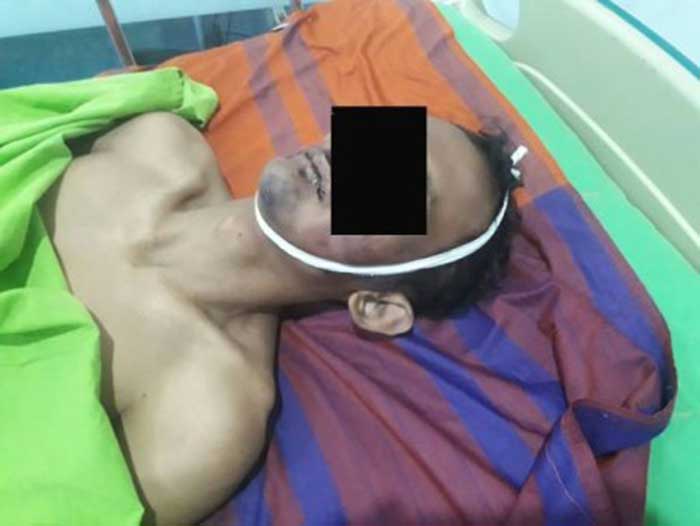 Ketika Urusan Meremas Payudara Dibayar Nyawa