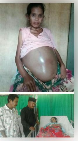 Warga Inhil Ini Butuh Bantuan, Ia Dirawat di RSUD Puri Husada