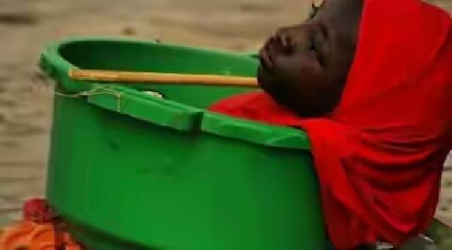 Kisah Mengharukan Gadis yang Hidup di Dalam Ember Plastik