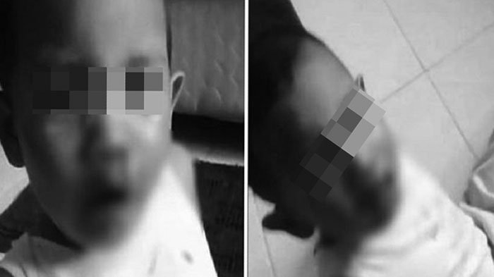 Suami Selingkuh, Ibu Hajar Anaknya Sambil Merekam, Videonya Viral di Facebook