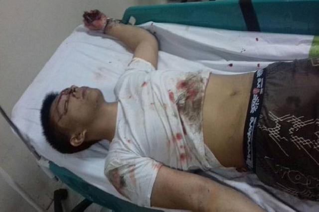 Kapolres Tangerang: Pelaku Diduga dari Jaringan ISIS