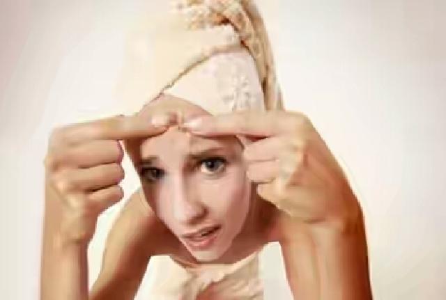 Studi Buktikan Kontrasepsi Oral Ampuh Obati Jerawat