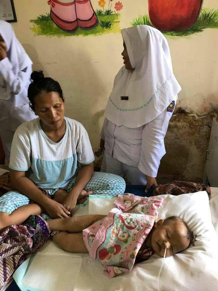 Balita Penderita Dermatitis Alergi di Inhil Meninggal Dunia